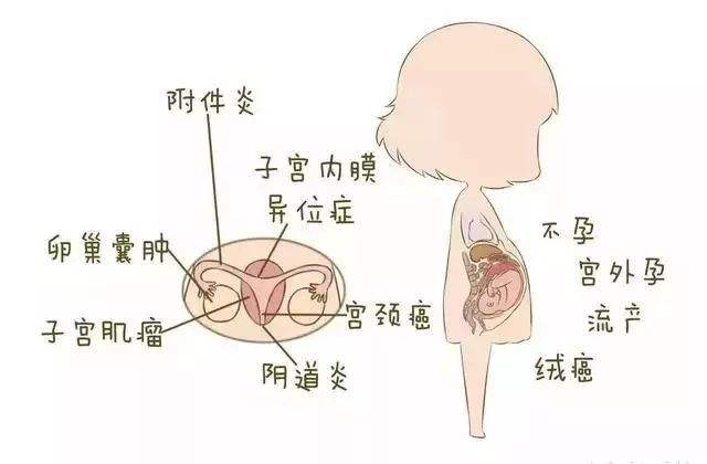 子宫肌瘤是一种激素依赖性肿瘤