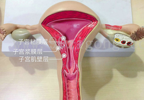 妇科“第一瘤”——子宫肌瘤