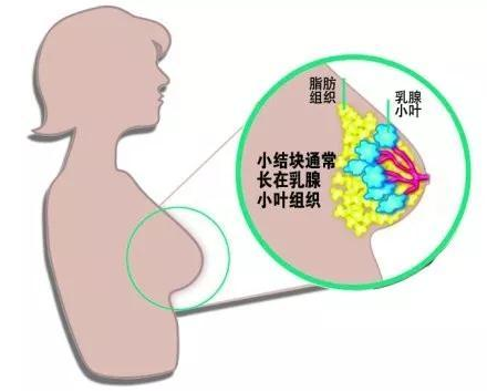 有吸烟习惯的人患胰腺癌的可能性是不吸烟的人的2至3倍