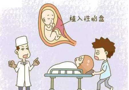 什么是胎盘植入？
